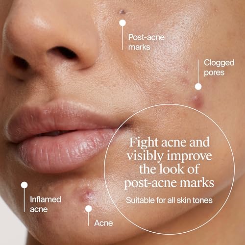 Image of Neutrogena Evenly Clear Retinoid Adapalene Gel 0.1% Acne Spot Treatment, Once-Daily Topical Retinoid Helps Clear Breakouts & Visible Improvement in the Appearance of Post-Acne Mark, 0.5 oz