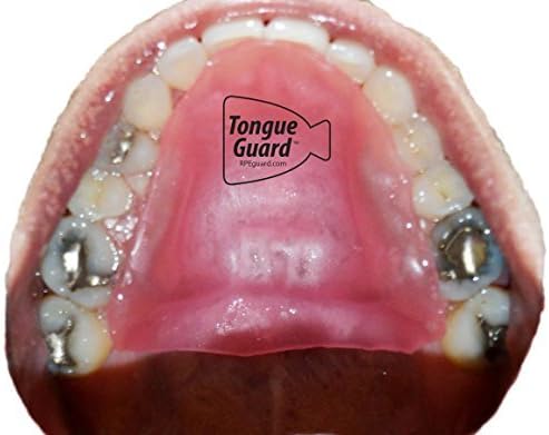 Miniatura 2 de Protector de lengua EP: previene y ayuda a curar las llagas de la lengua causadas por expansores dentales