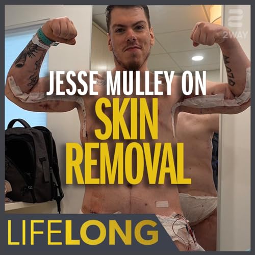 Jesse Mulley on Skin Removal Surgery & Losing 290 lbs | LifeLONG Ethan Suplee