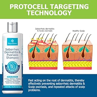 Seborrheic Dermatitis Shampoo, Psoriasis Shampoo, Folliculitis Shampoo, Scalp Psoriasis Shampoo, Dandruff Shampoo, Dry Itchy Scalp, Provides Soothing Relief