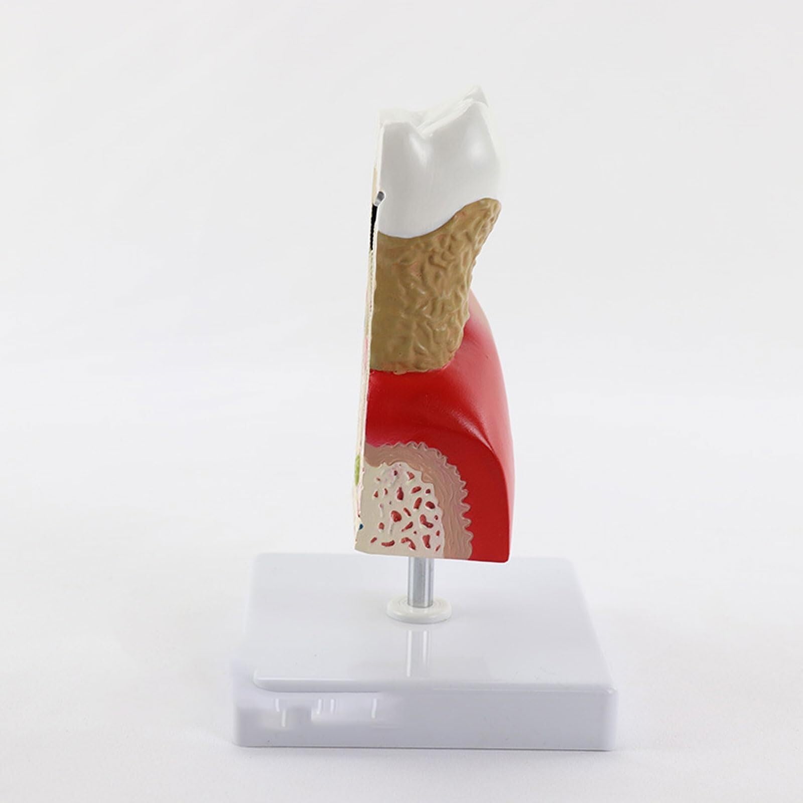 Anatomiczny Model Ludzi, Powiększony Model Opieki Ludzkich, Próchnicy, Próchnicy, Akcesoria Medyczne, Materiał Dydaktyczny, Model Anatomiczny.