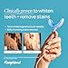 Laughland Super Strength Teeth Whitening Kit, Phone-Powered LED Mouthpiece & 3 Whitening Gel Syringes, 11% Hydrogen Peroxide, Glycerin, Aloe Vera & Mint, at Home Dental Care, 6+ Treatments