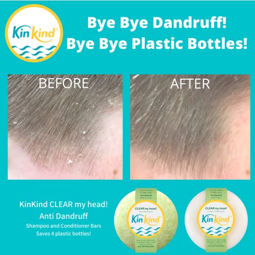 KinKind Anti Dandruff Shampoo Bar. CLEAR My Head! Anti Dandruff Shampoo for Women Kids & Men. Natural Solid Shampoo Bar to control Flaky Scalp - Image 4
