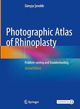 健康・医学 atlas of asian rhinoplasty Atlas of Asian Rhinoplasty: 9789811086441: Medicine & Health