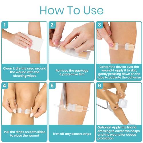 Image of ViveCare Emergency Laceration Closures (4 PCS) - Close Wounds Without | Stitches - Butterfly Bandages Wound Closure Kit with Sterile Strips, Island Dressings, Alcohol Wipes & Swabs