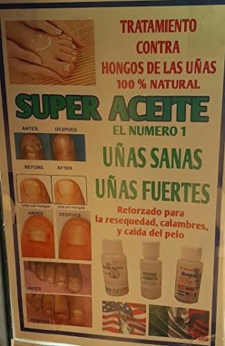 Miniatura 2 de Súper Aceite