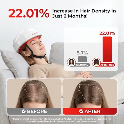 Image of Laser Red Light Therapy for Hair Growth,FDA Cleared Hair Growth Device for Men & Women,650nm Low Level Laser Therapy for Thinning Hair & Alopecia, 200 Lasers Full Scalp Coverage Home Use(KCA451-200S)