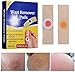 Produktbild Fuß und Hand Warze Remover Pads, Warze Callus Remover, Zur Behandlung hartnäckiger Warzen