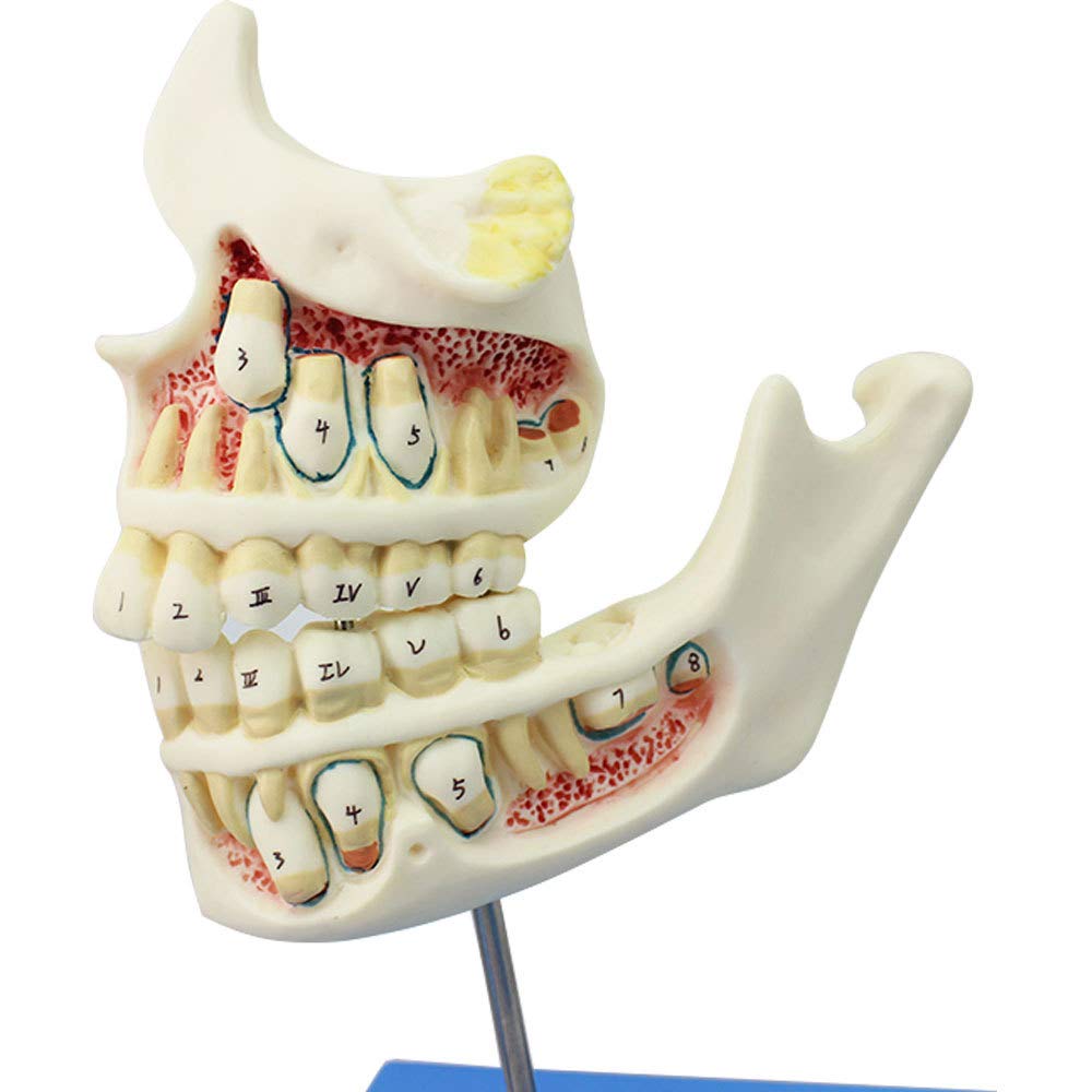 Denti Decidui Denti Permanenti Modello Sviluppo Dei Denti E Mascella Bambini Crescita Denti 4Stadi Modello Sviluppo Dentatura E Della Mascella Bambini Cura Dentale Orale Mascella Dentatura Denti