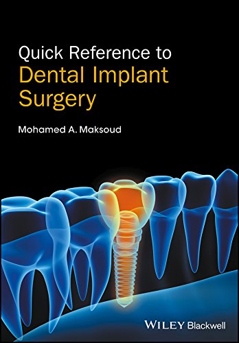 Ebook – Quick reference to dental implant surgery Edition (PDF Instant ...
