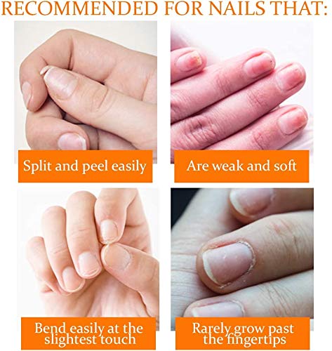 Nail Tek I0096865 Repairs Damaged Nails Kit.Intensive Therapy thumb #3