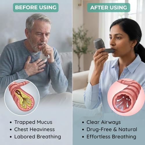 Image of B-Arm Mucus Removal Device For COPD |Lungs Expander with 5 Resistance Balls|Mucus Clearance Device for Lung Cleanse |Mucus Extractor for Asthma, Cystic Fibrosis, Bronchitis, Emphysema Patient