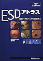 ESDアトラス―処置具の選択と部位別攻略法 4307101340 Book Cover