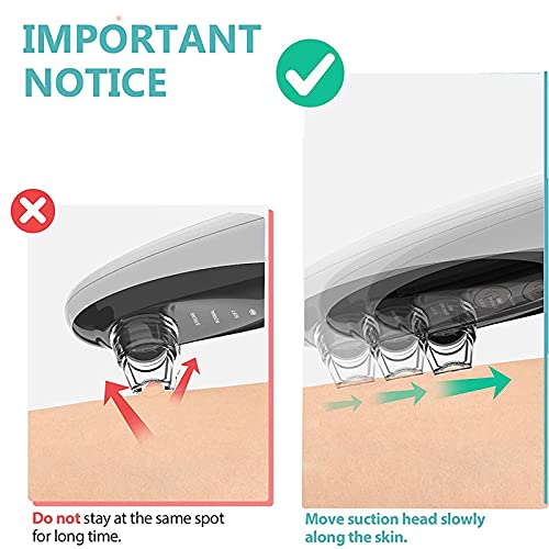 Removedor De Cravos Com CâMera VisíVel, Dispositivo EléTrico De SucçãO De Cravos 300.000 Pixels 64 K