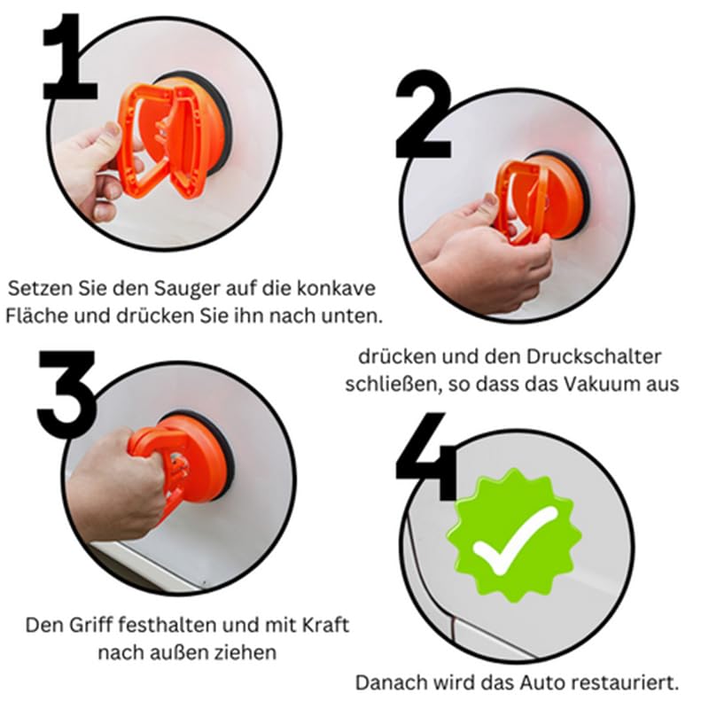 TOPBATHY 2-tlg. Vakuum-Dellenzieher Set - Saugnapfwerkzeug Für Auto-Dellen Ohne Lackschaden