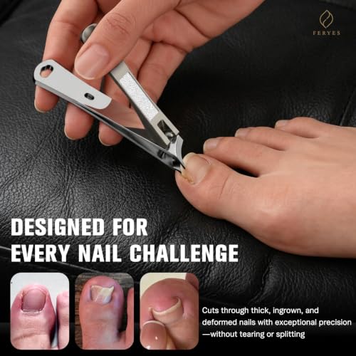 Image of FERYES Ingrown Toenail Clippers - Curved Slanted Blade Design for Nail Care