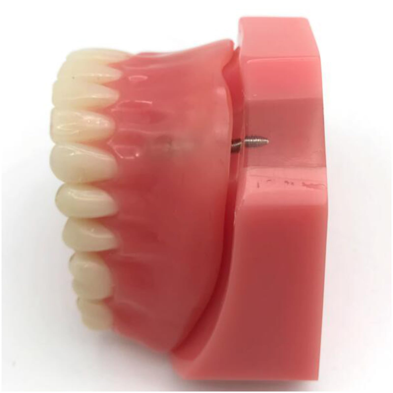 Modello di Denti dentali, Modello di restauro Dentale con 2 impianti, per Laboratorio odontotecnico di Ricerca didattica odontoiatrica