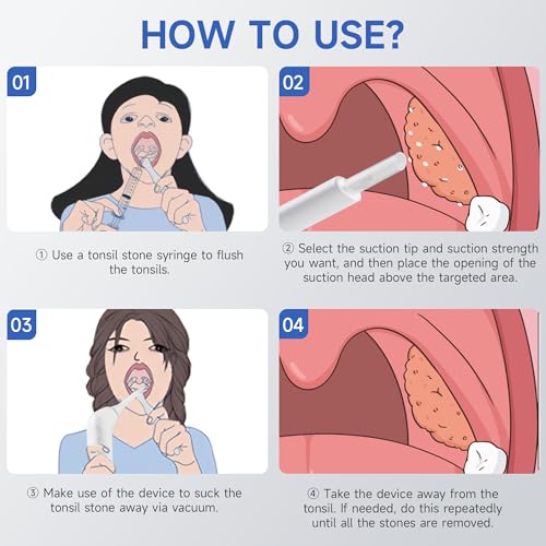Image of Electronic Tonsil Stone Remover, Vacuum Tonsil Stone Removal Kit with LED Light, 3 Suction Modes, Tonsil Stone Cleaner Tool, Oral Care for Mouth Health, USB Rechargeable (White 2)
