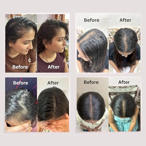 Image of SAYY Scalp Revival Hair Serum 50 ML and Rosemary Oil 100 ML Combo