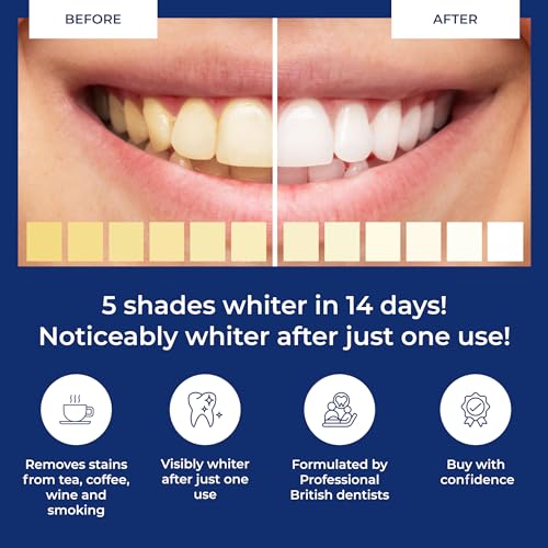 Tanden bleken strips - 20 Pap tanden whitener sessies - gemaakt in het Verenigd Koninkrijk - Niet-gevoelige 40 peroxidevrije strips - emaille veilig door SMILE:NOW - Image 4