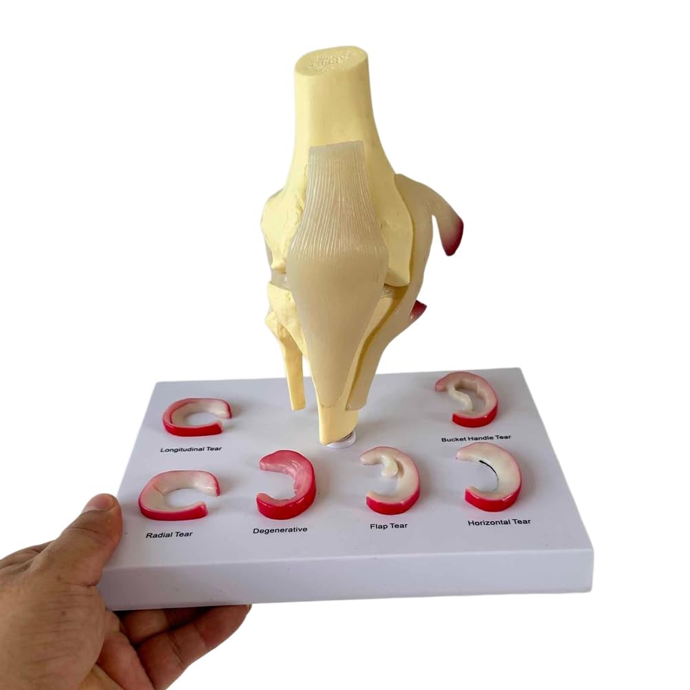 Modelo de articulación de Rodilla Humana Modelo de lesión de menisco Modelo de reparación de ligamento de Rodilla