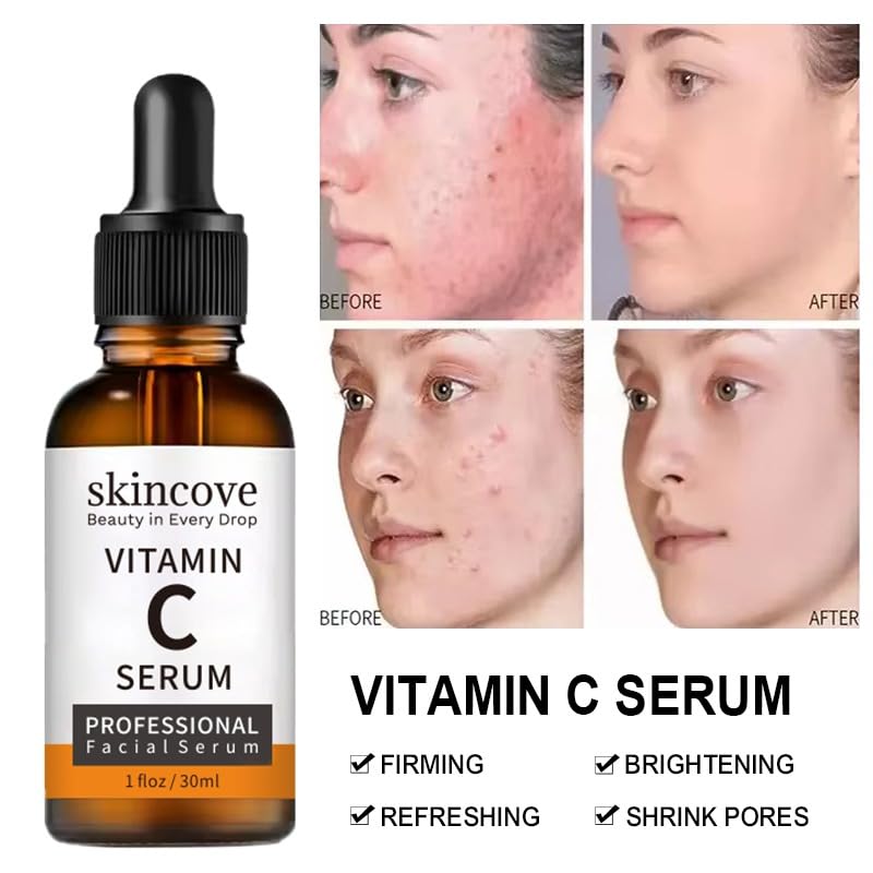 Miniatura 4 de Skincove Suero de vitamina C  Suero facial antienvejecimiento con vitamina C, ácido hialurónico, vitamina E  Suero iluminador  tono de piel