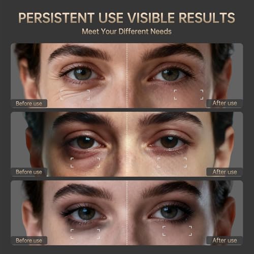 Image of Red Light Therapy for Eyes, 4-in-1 3 Minutes Treatment Under Eye Red Light Mask, Targets Fine Lines, Eye Bags, Wrinkles & Dark Circles, Rejuvenating Eye Massager for Men Women (Black)
