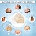 Scar Removal Sheet， Maybeau 7 PCS (7 Month Supply) Medical Silicone Scar Patch for on Keloid Surgery Injury Burns Acne C-Section Scars and More with Big Size (5.9