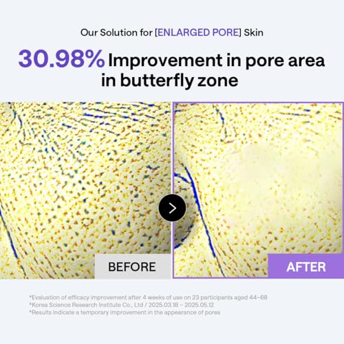Image of MEDIHEAL Toner Pads 100 Count - PDRN Stretchable Lifting Pads with Squalane and Glutathione for Total Skin Care - Plant Based Rose PDRN - Wrinkle & Pore Care - Vegan Stretchable Lifting Fabric