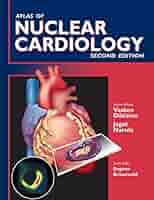 Atlas of Nuclear Cardiology | Amazon.com.br