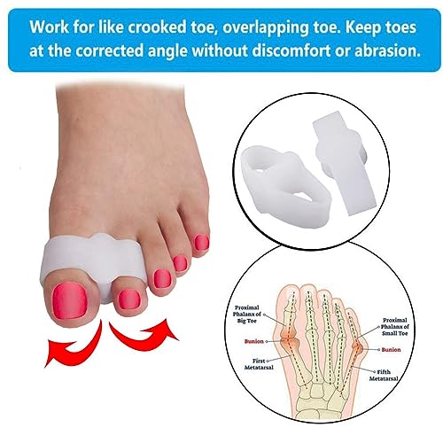 Image of 24 Pieces Toe Separators Bunion Corrector Toe Spacers with 2 Loops, Soft Gel Big Spacer Suitable for Bunion and Overlap