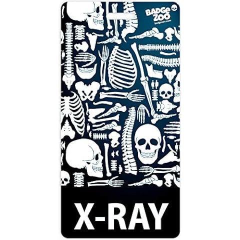 X-Ray Badge Buddy - Black - Skeleton Themed - Radiology Vertical Badge Id Card - by BadgeZoo Cover