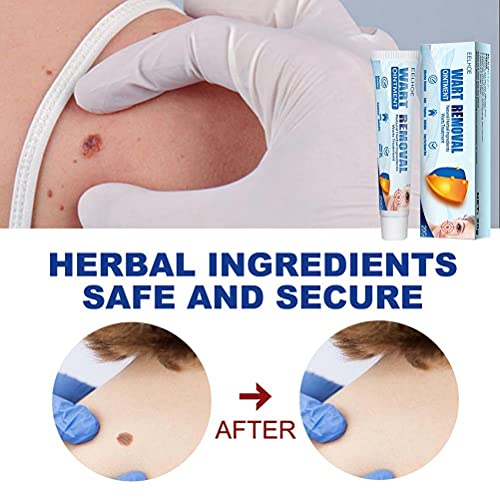 Wrattenverwijderaar, Huidlabelverwijderaar, Wrattenverwijderingscrème, Huidlabelverwijderingscrème voor Lichaam… - Image 3