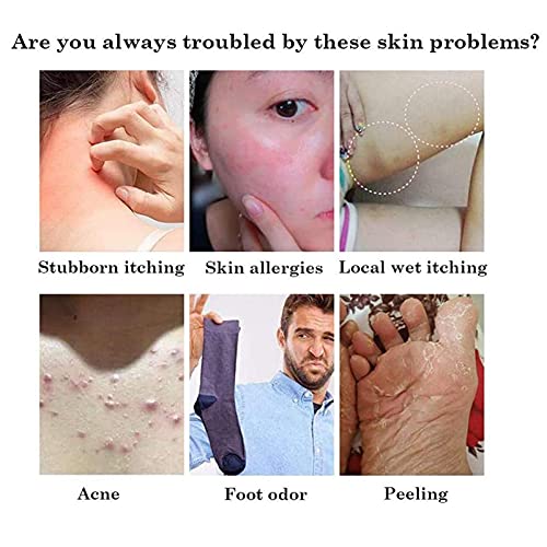 Natural Chinese Herbal Cream, Eczema Cream, Anti-Itch Cream, Dedicated for Dermatitis and Eczema Pruritus Psoriasis… - Afbeelding 3