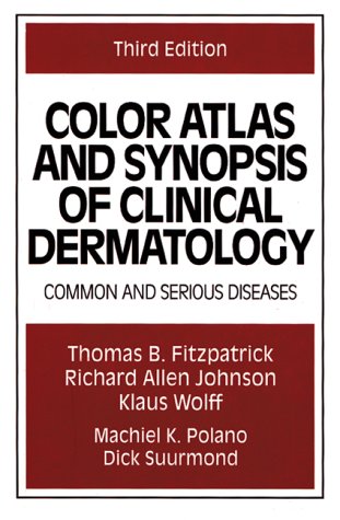 Amazon | Color Atlas and Synopsis of Clinical Dermatology: Common