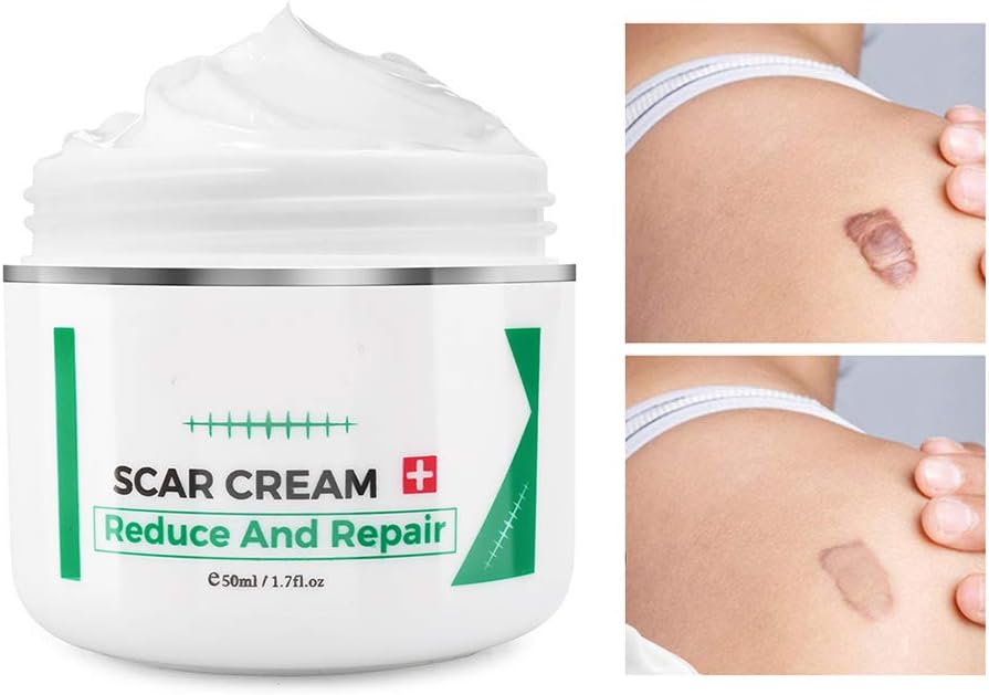 rimozione della cicatrice per il corpo