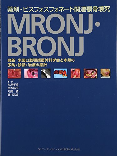 薬剤・ビスフォスフォネート関連顎骨壊死 MRONJ・BRONJ