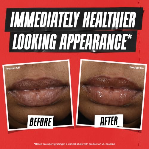 Kiehl's Ultra Mending Lip Gel, view 6