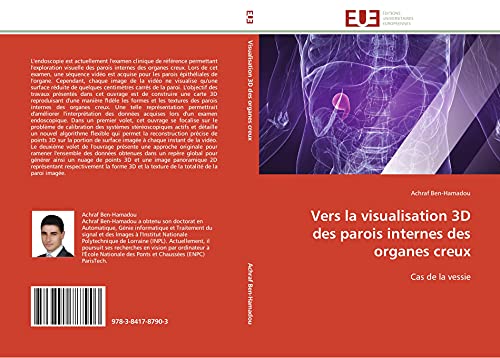 Vers la visualisation 3D des parois internes des organes creux: Cas de la vessie (Omn.Univ.Europ.)
