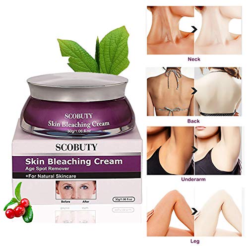 Skin Lightening Cream, Whitening Cream, Brightening Cream, Melasma Treatment Cream, Freckle Removal  - coolthings.us