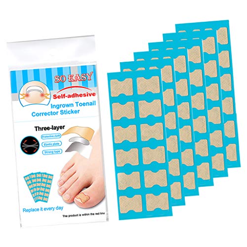 Baoblaze Ferramenta De Correção De Unhas Dos Dedos Encravados Órtese Corrector Brace Nail Treatment