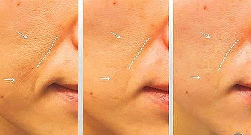 Whitesilk (1.69Oz, 10Ml X 5Vials) Anti-Aging Expert Power Ampoule With Scm(Human Stem Cell) And Bakuchiol And Melatonin #TOP4