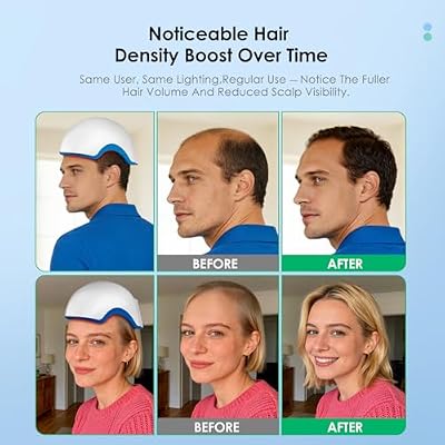 Red Light Therapy for Hair Growth Device, Laser Cap for Hair Regrowth, FDA Therapy Hair Loss Treatment System