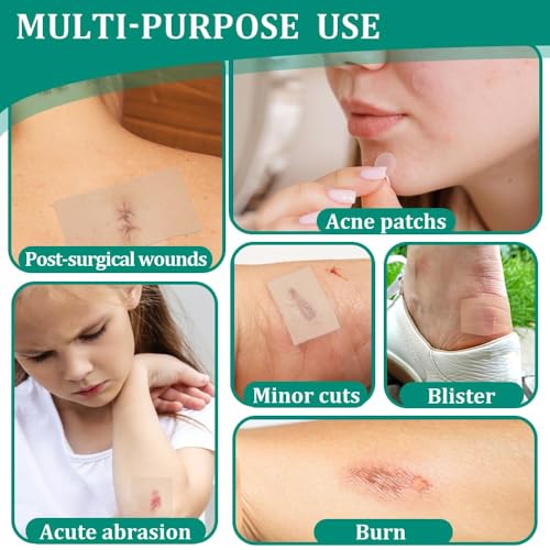 Image of Hydrocolloid Roll, Hydrocolloid Tape, 5 cmx150 cm Waterproof Skin Patch Tape, Cut-to-Size, Self-Adhesive Skinfriendly Hydrocolloid Tape Patches Pads