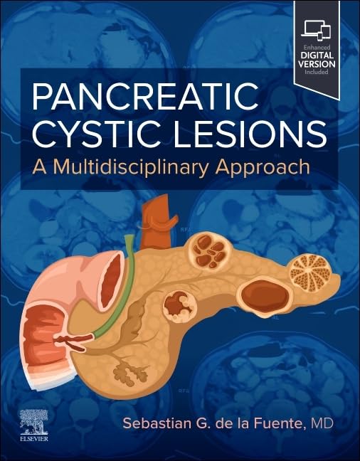 Pancreatic Cystic Lesions: A Multidisciplinary Approach: A Multidisciplinary Approach