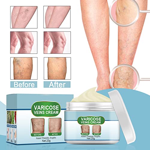 Crema riparatrice delle gambe di ragno, per il