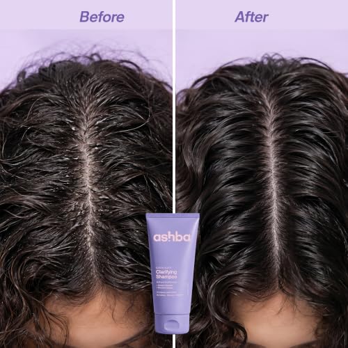 Image of Ashba Botanics Clarifying Shampoo for Curly, Wavy, Frizzy & Dry Hair | Sulfate-Free Deep Cleansing Shampoo | Removes Product Buildup & Hard Water Minerals | With Vitamin C, AHA Fruit Acids & Trehalose | 200ml