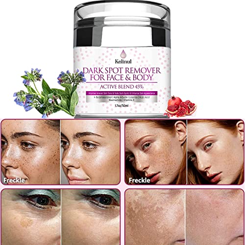 Dark Spot Remover for Face - Dark Spot Corrector and Remover â€“ for use on face, body, or sensitive intimate areas. Packed with vitamins and natural extracts to treat dark spots, age spots, or sunspots(1.7 FL.OZ)