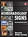 Neuroradiology Signs