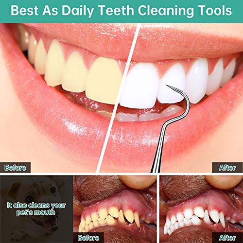Polkastore PL-01 Professional Dental Scraper Tool thumb #4